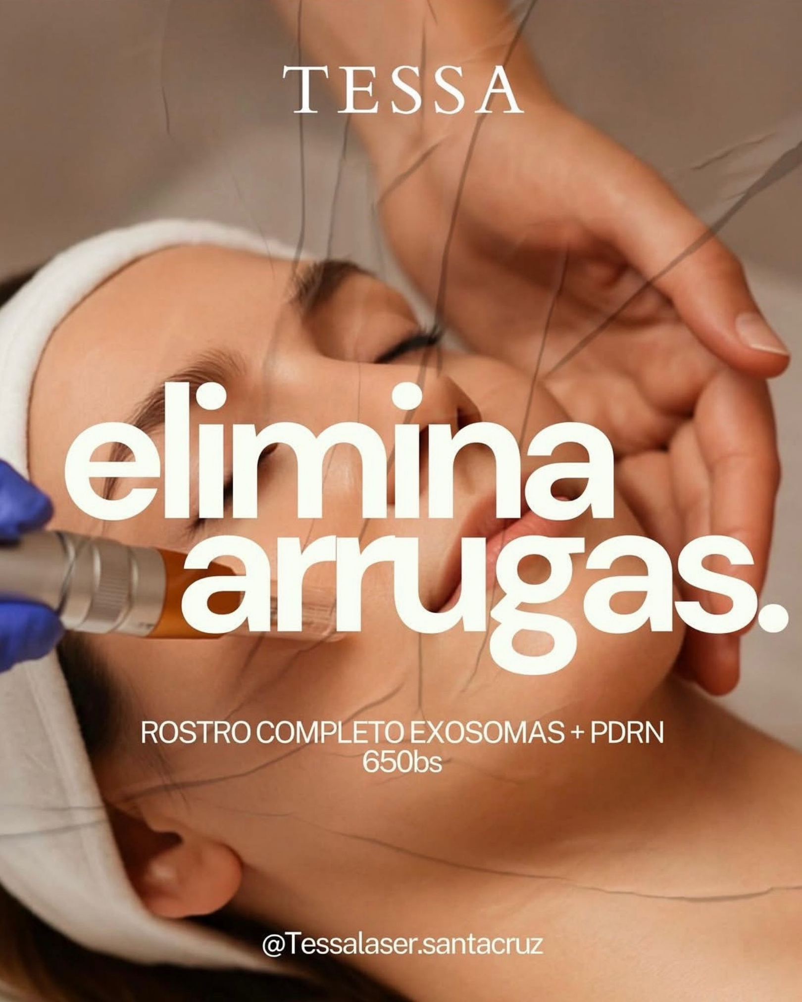Arte